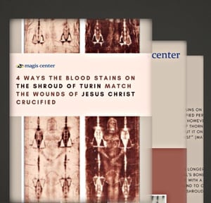 Click to view 4 ways the blood stains on the Shroud of Turin match the wounds of Jesus Christ.